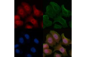 ABIN6255395 and ABIN6266473 staining Hela cells by IF/ICC. (ALOX5 Antikörper  (pSer523))