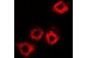 Immunofluorescent analysis of HADHB staining in A549 cells. (HADHB Antikörper)