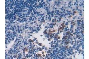 Immunohistochemistry (IHC) image for anti-Cytoglobin (CYGB) (AA 1-190) antibody (ABIN7434902)