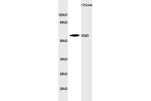 SDS-PAGE (SDS) image for anti-Cytochrome P450, Family 24, Subfamily A, Polypeptide 1 (CYP24A1) (AA 351-450) antibody (ABIN750838)