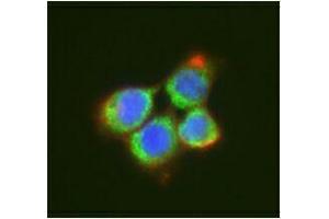 Immunofluorescence (IF) image for anti-DEAD (Asp-Glu-Ala-Asp) Box Polypeptide 6 (DDX6) antibody (ABIN2664929) (DDX6 Antikörper)
