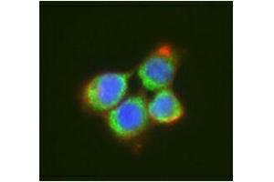 Immunofluorescence (IF) image for anti-DEAD (Asp-Glu-Ala-Asp) Box Polypeptide 6 (DDX6) antibody (ABIN2664929) (DDX6 Antikörper)