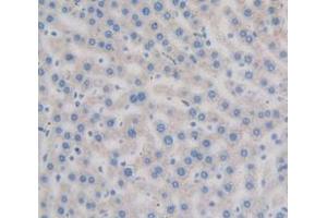 Used in DAB staining on fromalin fixed paraffin- embedded Kidney tissue (Axin Antikörper  (AA 618-827))