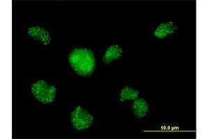 Immunofluorescence of purified MaxPab antibody to CALML3 on HeLa cell. (CALML3 Antikörper  (AA 1-149))