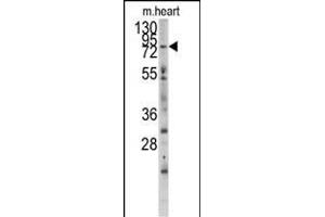 Western blot analysis of anti-MYLK3 Antibody (N-term) (ABIN392494 and ABIN2837985) in mouse heart tissue lysates (35 μg/lane). (MYLK3 Antikörper  (N-Term))