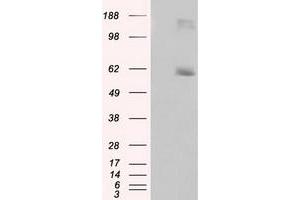 HEK293T cells were transfected with the pCMV6-ENTRY control (Left lane) or pCMV6-ENTRY LIPG (Right lane) cDNA for 48 hrs and lysed. (LIPG Antikörper)