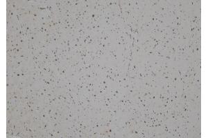 ABIN6257308 and ABIN6275887 at 1/100 staining Human heart tissue by IHC-P. (LHX1 Antikörper  (Internal Region))