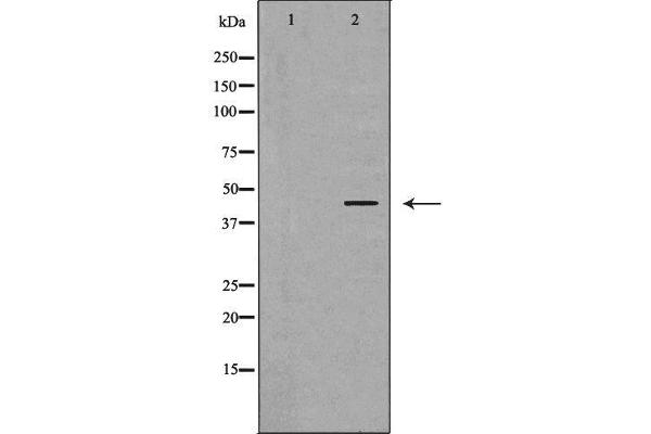 PRKAR1A Antikörper  (N-Term)