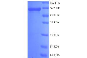 SDS-PAGE (SDS) image for P21-Activated Kinase 4 (PAK4) (AA 1-426) protein (His-SUMO Tag) (ABIN5710063) (PAK4 Protein (AA 1-426) (His-SUMO Tag))