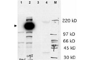 Image no. 1 for anti-Castor Zinc Finger 1 (CASZ1) (N-Term) antibody (ABIN401359) (CASZ1 Antikörper  (N-Term))