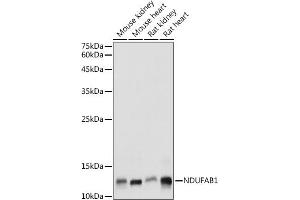 Western Blotting (WB) image for anti-NADH Dehydrogenase (Ubiquinone) 1, alpha/beta Subcomplex, 1, 8kDa (NDUFAB1) (AA 50-150) antibody (ABIN7268817)