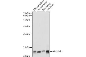 Western blot analysis of extracts of various cell lines, using NDUF antibody (ABIN7268817) at 1:1000 dilution. (NDUFAB1 Antikörper  (AA 50-150))