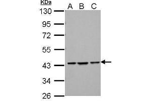 WB Image Sample (30 ug of whole cell lysate) A: NIH-3T3 B: JC C: BCL-1 10% SDS PAGE antibody diluted at 1:1000 (ZBTB24 Antikörper  (C-Term))