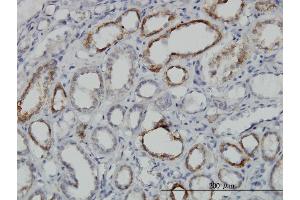 Immunoperoxidase of monoclonal antibody to DLD on formalin-fixed paraffin-embedded human kidney. (DLD Antikörper  (AA 1-509))