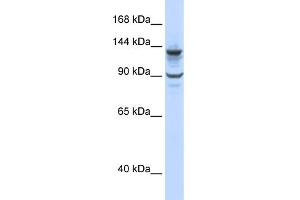 WB Suggested Anti-PGBD1 Antibody Titration:  0. (PGBD1 Antikörper  (N-Term))