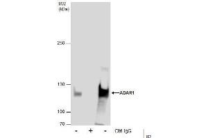 Immunoprecipitation (IP) image for anti-Adenosine Deaminase, RNA-Specific (ADAR) antibody (ABIN2855100)