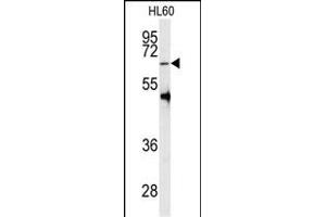 Western blot analysis of anti-PRMT5 Antibody (C-term ) (ABIN387841 and ABIN2843949) in HL60 cell line lysates (35 μg/lane). (PRMT5 Antikörper  (C-Term))