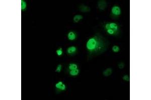 Anti-TP53 mouse monoclonal antibody (ABIN2454485) immunofluorescent staining of COS7 cells transiently transfected by pCMV6-ENTRY TP53 (RC200003). (p53 Antikörper)