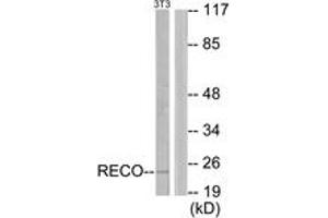 Western blot analysis of extracts from NIH-3T3 cells, using Recoverin Antibody. (Recoverin Antikörper  (AA 107-156))
