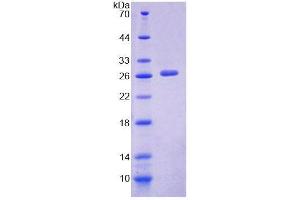SDS-PAGE analysis of Mouse PTPN3 Protein. (PTPN3 Protein)