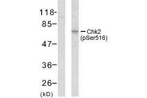 Western blot analysis of extracts from HeLa cells using Chk2 (phospho-Ser516) antibody (E011147). (CHEK2 Antikörper  (pSer516))