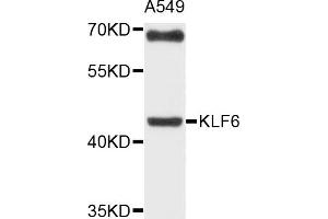 Western blot analysis of extracts of A-549 cells, using KLF6 antibody (ABIN6003718) at 1/1000 dilution. (KLF6 Antikörper)