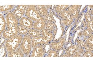 Detection of MMP8 in Human Kidney Tissue using Monoclonal Antibody to Matrix Metalloproteinase 8 (MMP8) (MMP8 Antikörper  (AA 101-467))