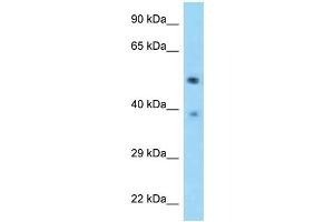 WB Suggested Anti-TSEN2 Antibody Titration: 1. (TSEN2 Antikörper  (C-Term))