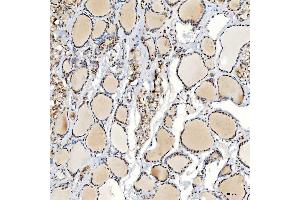 IHC analysis of U1-C/SNRPC using anti-U1-C/SNRPC antibody (ABIN7599016).