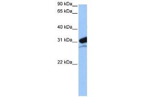 MRPL24 antibody used at 0. (MRPL24 Antikörper  (N-Term))