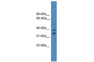 WB Suggested Anti-UFD1L Antibody Titration: 0. (UFD1L Antikörper  (Middle Region))