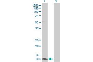 Western Blot analysis of CRABP2 expression in transfected 293T cell line by CRABP2 MaxPab polyclonal antibody. (CRABP2 Antikörper  (AA 1-138))