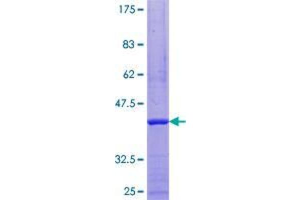 RRN3 Protein (AA 1-106) (GST tag)