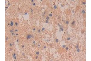Immunohistochemistry (IHC) image for anti-Dimethylarginine Dimethylaminohydrolase 2 (DDAH2) (AA 31-265) antibody (ABIN7435682)