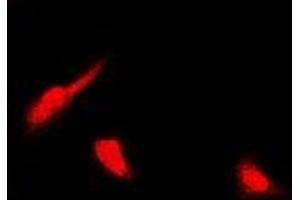Immunofluorescence (IF) image for anti-Proteasome (Prosome, Macropain) Subunit, beta Type, 4 (PSMB4) antibody (ABIN7306370)