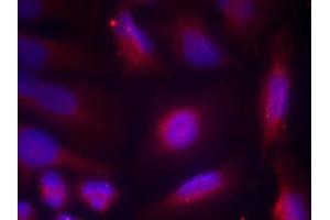 Immunofluorescence staining of methanol-fixed HeLa cells using TrkA (Phospho-Ser791) Antibody (E011326, Red) (TRKA Antikörper  (pSer791))