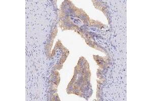 Immunohistochemical staining of human prostate with TCHHL1 polyclonal antibody  shows moderate cytoplasmic positivity in glandular cells. (TCHHL1 Antikörper)