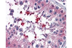 IHC testing of FFPE human testis tissue with ABCD4 antibody at 3.