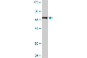 Western Blot detection against Immunogen (63. (STEAP1 Antikörper  (AA 1-339))