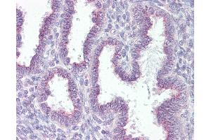 Anti-RER1 antibody IHC of human uterus. (RER1 Antikörper  (AA 179-192))