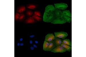 ABIN6257123 and ABIN6273439 staining  cells by IF/ICC.