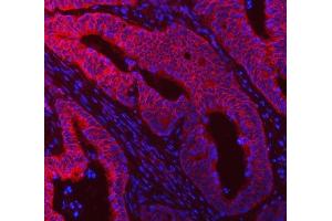 IF analysis of DDX58 using anti-DDX58 antibody (ABIN5518906). (DDX58 Antikörper  (AA 871-925))