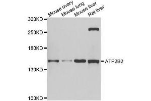 Western blot analysis of extracts of various cell lines, using ATP2B2 antibody. (ATP2B2 Antikörper  (AA 1-80))