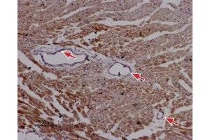 Expression of RyR2 in rat cardiac muscle - Immunohistochemical staining of paraffin-embedded sections of rat myocardium using Anti-Ryanodine Receptor 2 Antibody (ABIN7043605, ABIN7045213 and ABIN7045214), (1:50). (RYR2 Antikörper  (Intracellular))