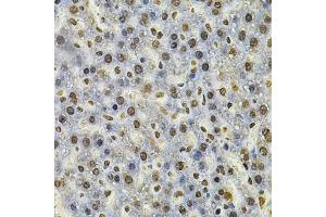 Immunohistochemistry of paraffin-embedded rat liver using IFI16 Antibody (ABIN6129036, ABIN6142162, ABIN6142163 and ABIN6218202) at dilution of 1:100 (40x lens). (IFI16 Antikörper  (AA 1-300))