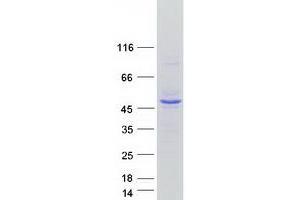 Western Blotting (WB) image for Inositol Polyphosphate-1-Phosphatase (INPP1) (Transcript Variant 2) protein (Myc-DYKDDDDK Tag) (ABIN2723478)