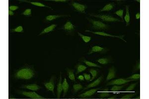 Immunofluorescence (IF) image for anti-Deformed Epidermal Autoregulatory Factor 1 (Drosophila) (DEAF1) (AA 1-565) antibody (ABIN523921)