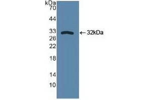 Western blot analysis of recombinant Human SPHK1. (SPHK1 Antikörper  (AA 148-398))