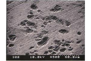 Immunohistochemistry (IHC) image for Osteoclast (Rat) Culture Kit (ABIN956046) (Osteoclast (Ratte) Culture Kit)