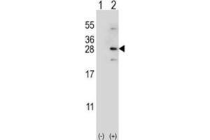 Western Blotting (WB) image for anti-NADH Dehydrogenase (Ubiquinone) Fe-S Protein 4, 18kDa (NADH-Coenzyme Q Reductase) (NDUFS4) antibody (ABIN3002889) (NDUFS4 Antikörper)